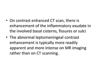 • On contrast enhanced CT scan, there is
enhancement of the inflammatory exudate in
the involved basal cisterns, fissures or sulci
• The abnormal leptomeningeal contrast
enhancement is typically more readily
apparent and more intense on MR imaging
rather than on CT scanning.
 