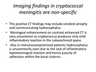 Imaging findings in cryptococcal
meningitis are non-specific
• The positive CT findings may include cerebral atrophy
and communicating hydrocephalus.
• Meningeal enhancement on contrast enhanced CT is
very uncommon as cryptococcus produces only mild
inflammatory reaction in the subarachnoid space.
• Also in immunocompromised patients hydrocephalus
is uncommonly seen due to the lack of inflammatory
leptomeningeal reaction and hence paucity of
adhesions within the basal cisterns.
 