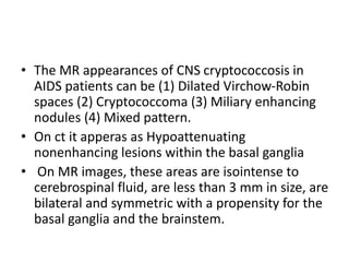 • The MR appearances of CNS cryptococcosis in
AIDS patients can be (1) Dilated Virchow-Robin
spaces (2) Cryptococcoma (3) Miliary enhancing
nodules (4) Mixed pattern.
• On ct it apperas as Hypoattenuating
nonenhancing lesions within the basal ganglia
• On MR images, these areas are isointense to
cerebrospinal fluid, are less than 3 mm in size, are
bilateral and symmetric with a propensity for the
basal ganglia and the brainstem.
 