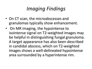 Imaging Findings
• On CT scan, the microabscesses and
granulomas typically show enhancement.
• On MR imaging, the hypointense to
isointense signal on T2-weighted images may
be helpful in distinguishing fungal granuloma.
A target appearance has also been described
in candidal abscess, which on T2-weighted
images shows a well-delineated hypointense
area surrounded by a hyperintense rim.
 
