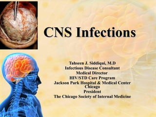 CNS Infections Tahseen J. Siddiqui, M.D Infectious Disease Consultant Medical Director  HIV/STD Care Program Jackson Park Hospital & Medical Center Chicago President The Chicago Society of Internal Medicine 