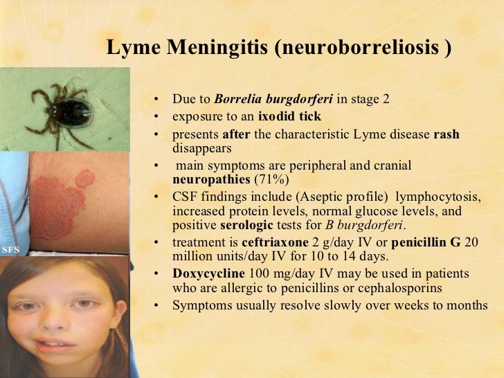CNS Infections Siddiqui