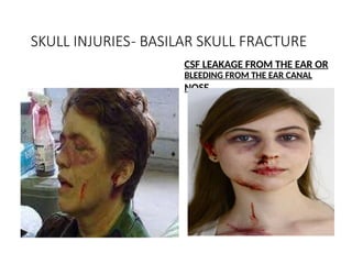 Skull Potential Injuries Comprehensive Overview of Head and Spinal Cord Injuries: Anatomy ...