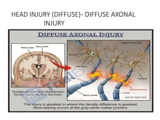 Comprehensive Overview of Head and Spinal Cord Injuries: Anatomy ...