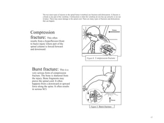 Comprehensive Overview of Head and Spinal Cord Injuries: Anatomy ...