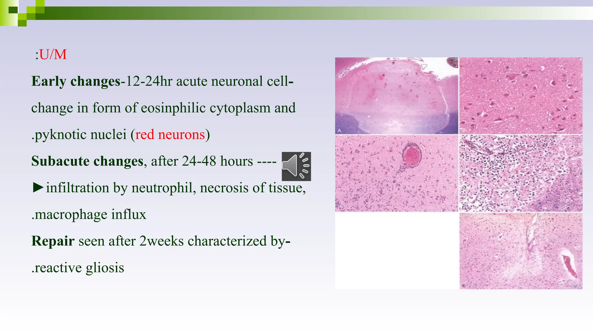 U/M
:
-
Early changes-12-24hr acute neuronal cell
change in form of eosinphilic cytoplasm and
pyknotic nuclei (red neurons)
.
-
Subacute changes, after 24-48 hours ---
►infiltration by neutrophil, necrosis of tissue,
macrophage influx
.
-
Repair seen after 2weeks characterized by
reactive gliosis
.
 