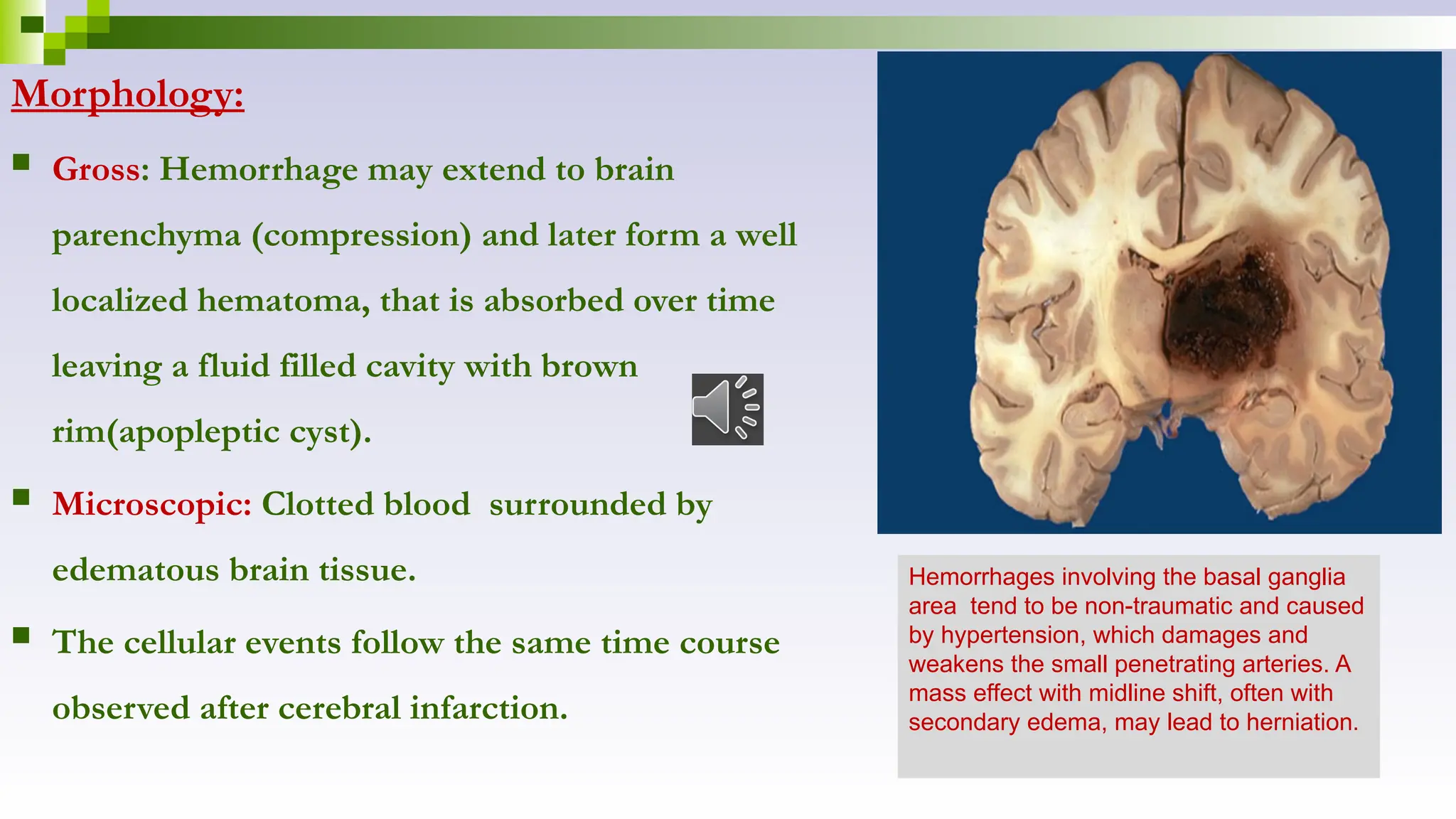 Morphology:
 Gross: Hemorrhage may extend to brain
parenchyma (compression) and later form a well
localized hematoma, that is absorbed over time
leaving a fluid filled cavity with brown
rim(apopleptic cyst).
 Microscopic: Clotted blood surrounded by
edematous brain tissue.
 The cellular events follow the same time course
observed after cerebral infarction.
Hemorrhages involving the basal ganglia
area tend to be non-traumatic and caused
by hypertension, which damages and
weakens the small penetrating arteries. A
mass effect with midline shift, often with
secondary edema, may lead to herniation.
 