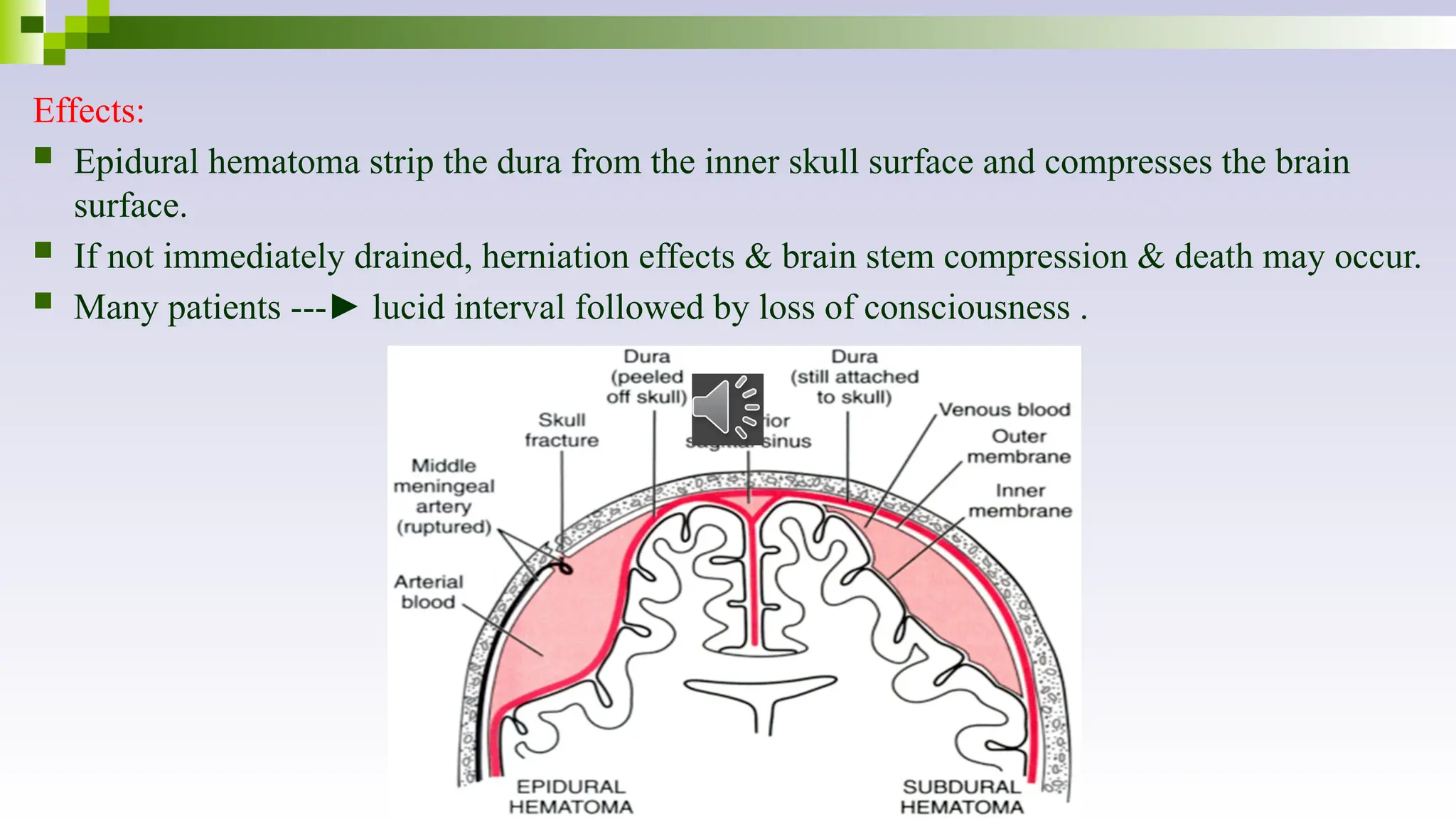 Effects:
 Epidural hematoma strip the dura from the inner skull surface and compresses the brain
surface.
 If not immediately drained, herniation effects & brain stem compression & death may occur.
 Many patients ---► lucid interval followed by loss of consciousness .
 
