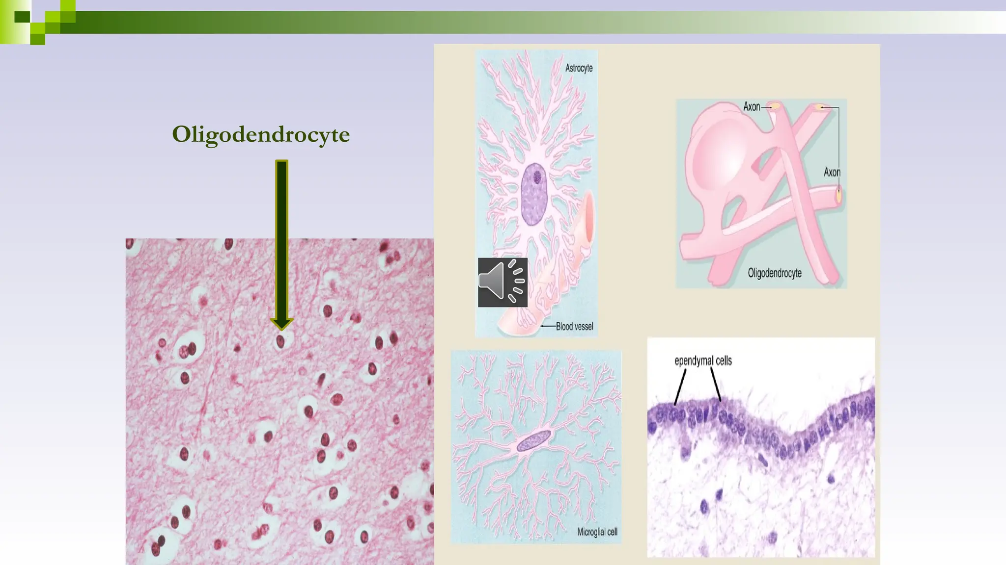 Oligodendrocyte
 