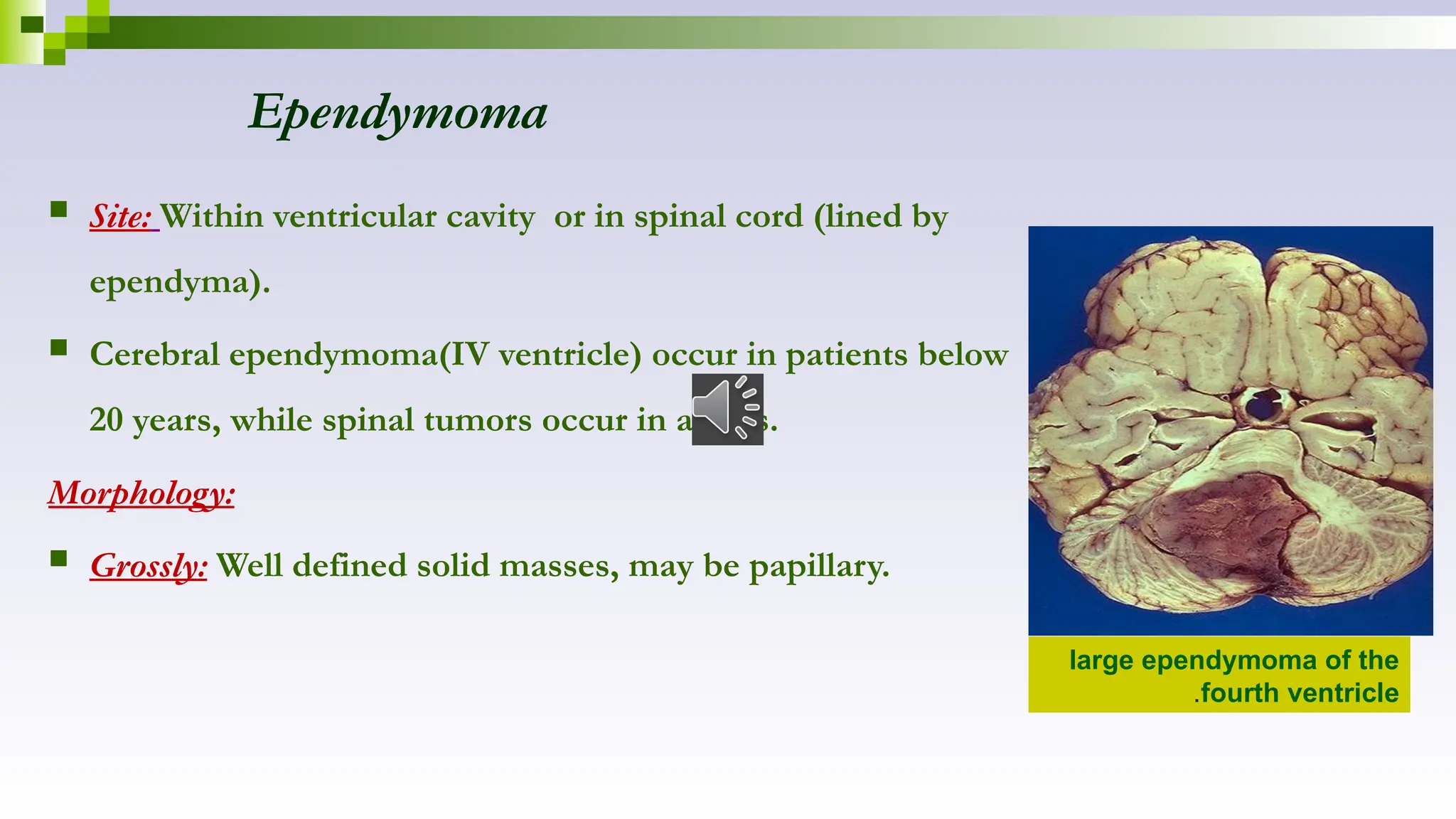 Ependymoma
 Site: Within ventricular cavity or in spinal cord (lined by
ependyma).
 Cerebral ependymoma(IV ventricle) occur in patients below
20 years, while spinal tumors occur in adults.
Morphology:
 Grossly: Well defined solid masses, may be papillary.
large ependymoma of the
fourth ventricle
.
 