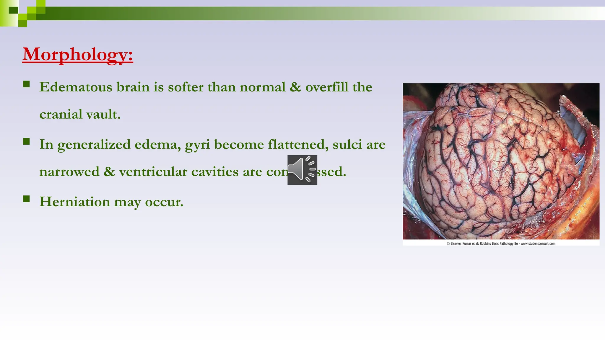 Morphology:
 Edematous brain is softer than normal & overfill the
cranial vault.
 In generalized edema, gyri become flattened, sulci are
narrowed & ventricular cavities are compressed.
 Herniation may occur.
 