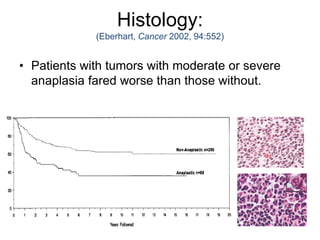 Histology:
(Eberhart, Cancer 2002, 94:552)
• Patients with tumors with moderate or severe
anaplasia fared worse than those without.
 