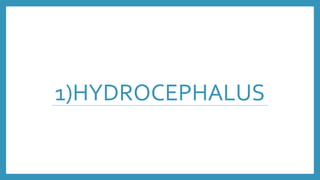 1)HYDROCEPHALUS
 