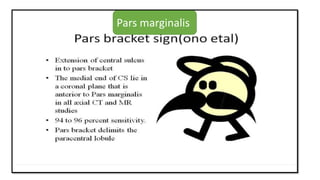 Pars marginalis
 
