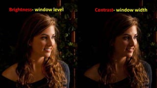 Brightness- window level Contrast- window width
13
 