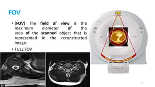FOV
• (FOV) The field of view is the
maximum diameter of the
area of the scanned object that is
represented in the reconstructed
image.
• FULL FOV
17
 