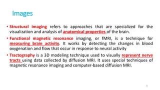 Images
• Structural imaging refers to approaches that are specialized for the
visualization and analysis of anatomical properties of the brain.
• Functional magnetic resonance imaging, or fMRI, is a technique for
measuring brain activity. It works by detecting the changes in blood
oxygenation and flow that occur in response to neural activity
• Tractography is a 3D modeling technique used to visually represent nerve
tracts using data collected by diffusion MRI. It uses special techniques of
magnetic resonance imaging and computer-based diffusion MRI.
25
 