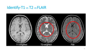 Identify-T1 VS T2 VS FLAIR
34
 