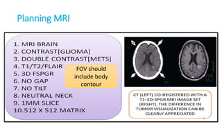 Planning MRI
38
FOV should
include body
contour
 