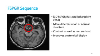 FSPGR Sequence
• [3D FSPGR (fast spoiled gradient
echo)
• More differentiation of normal
structure
• Contrast as well as non contrast
• Improves anatomical display
40
 