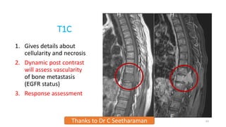 T1C
1. Gives details about
cellularity and necrosis
2. Dynamic post contrast
will assess vascularity
of bone metastasis
(EGFR status)
3. Response assessment
Thanks to Dr C Seetharaman 63
 