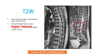T2W
1. Adds information about morphology of
bones and soft tissue.
2. Most pathological lesions appear
hyper intenseagainst
normal marrow
Thanks to Dr C Seetharaman 64
 