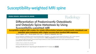 Susceptibility-weighted MRI spine
67
Susceptibility-weighted MRI enables the reliable differentiation between predominantly osteoblastic and
osteolytic spine metastases with a higher accuracy than standard MRI sequences
 
