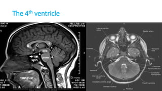 The 4th ventricle
 