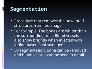 Segmentation
 Procedure that removes the unwanted
structures from the image
 For Example, The bones are whiter than
the surrounding area. Blood vessels
also show brightly when injected with
iodine-based contrast agent
 By segmentation, bone can be removed
and blood vessels can be seen in detail
 