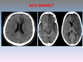 CNS Imaging for Medical Students | PPTX