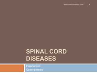www.medicinemcq.com

SPINAL CORD
DISEASES
Paraparesis
Quadriparesis

1

 