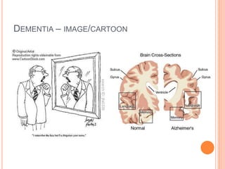 Dementia – image/cartoon
 