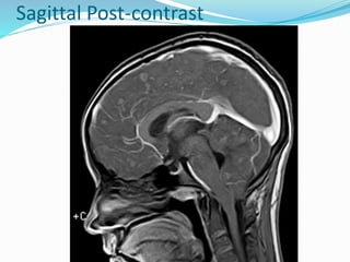 Sagittal Post-contrast
 