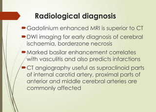 Radiological diagnosis
Gadolinium enhanced MRI is superior to CT
DWI imaging for early diagnosis of cerebral
ischaemia, borderzone necrosis
Marked basilar enhancement correlates
with vasculitis and also predicts infarctions
CT angiography useful as supraclinoid parts
of internal carotid artery, proximal parts of
anterior and middle cerebral arteries are
commonly affected
 