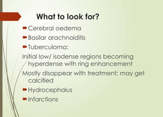 What to look for?
Cerebral oedema
Basilar arachnoiditis
Tuberculoma:
Initial low/ isodense regions becoming
hyperdense with ring enhancement
Mostly disappear with treatment; may get
calcified
Hydrocephalus
Infarctions
 