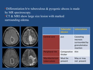 •Differentiation b/w tuberculous & pyogenic abcess is made
by MR spectroscopy.
•CT & MRI show large size lesion with marked
surrounding edema.
Tubercular
abscess
tuberculoma
Central core pus Caseating
necrosis
surrounded by
granulomatus
reaction
Peripheral rim Comparative
thicker
thin
Mycobacterium
tuberculosis
Must be
present
May or may
not present
 
