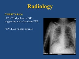 Radiology
CHEST X RAY:
•50% TBM pt have CXR
suggesting active/previous PTB.
•10% have miliary disease.
 