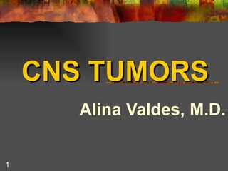 CNS TUMORS Alina Valdes, M.D. 
