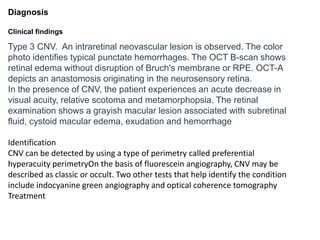 Diagnosis
Clinical findings
Type 3 CNV. An intraretinal neovascular lesion is observed. The color
photo identifies typical punctate hemorrhages. The OCT B-scan shows
retinal edema without disruption of Bruch's membrane or RPE. OCT-A
depicts an anastomosis originating in the neurosensory retina.
In the presence of CNV, the patient experiences an acute decrease in
visual acuity, relative scotoma and metamorphopsia. The retinal
examination shows a grayish macular lesion associated with subretinal
fluid, cystoid macular edema, exudation and hemorrhage
Identification
CNV can be detected by using a type of perimetry called preferential
hyperacuity perimetryOn the basis of fluorescein angiography, CNV may be
described as classic or occult. Two other tests that help identify the condition
include indocyanine green angiography and optical coherence tomography
Treatment
 