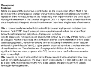 Management
Treatment
Taking into account the numerous recent studies on the treatment of CNV in AMD, it has
been shown that antiangiogenic therapy shows the best result both histologically with the
regression of the neovascular lesion and functionally with improvement of the visual acuity.
Although the treatment is the same for all types of CNV, it is important to differentiate them,
since they do not all respond identically and some of them have a higher rate of recurrence.
CNV is conventionally treated with intravitreal injections of angiogenesis inhibitors (also
known as "anti-VEGF" drugs) to control neovascularization and reduce the area of fluid
below the retinal pigment epithelium. Angiogenesis inhibitors
include pegaptanib, ranibizumab and bevacizumab (known by a variety of trade names, such
as Macugen, Avastin or Lucentis). These inhibitors slow or stop the formation of new blood
vessels (angiogenesis), typically by binding to or deactivating the transmission of vascular
endothelial growth factor ('VEGF'), a signal protein produced by cells to stimulate formation
of new blood vessels. The effectiveness of angiogenesis inhibitors has been shown to
significantly improve visual prognosis with CNV, the recurrence rate for these neovascular
areas remains high.
CNV may also be treated with photodynamic therapy coupled with a photosensitive drug
such as verteporfin (Visudyne). The drug is given intravenously. It is then activated in the eye
by a laser light. The drug destroys the new blood vessels, and prevents any new vessels
forming by forming thrombi.
 