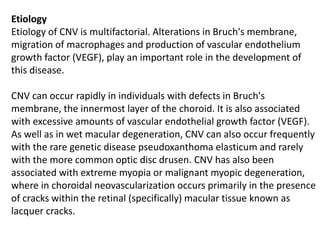 Etiology
Etiology of CNV is multifactorial. Alterations in Bruch's membrane,
migration of macrophages and production of vascular endothelium
growth factor (VEGF), play an important role in the development of
this disease.
CNV can occur rapidly in individuals with defects in Bruch's
membrane, the innermost layer of the choroid. It is also associated
with excessive amounts of vascular endothelial growth factor (VEGF).
As well as in wet macular degeneration, CNV can also occur frequently
with the rare genetic disease pseudoxanthoma elasticum and rarely
with the more common optic disc drusen. CNV has also been
associated with extreme myopia or malignant myopic degeneration,
where in choroidal neovascularization occurs primarily in the presence
of cracks within the retinal (specifically) macular tissue known as
lacquer cracks.
 