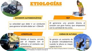 ETIOLOGÍAS
RCP
Al generarse una presión directa al
corazón con gran fuerza, que empeorará
con la cantidad de los ciclos.
ACCIDENTE AUTOMOVILÍSTICO
La velocidad que debe ir un conductor
para generar tal daño debe ser > 35km/h
CAÍDAS DE ALTURASATROPELLOS
Debido al trauma cerrado
por el impacto con el
vehículo y al contacto con
el pavimento.
Se genera un aumento de
la presión intraabdominal,
cuando la altura es mayor
supera los 6 m
Raja AS. Thoracic trauma. In: Walls RM, Hockberger RS, Gausche-Hill M, eds. Rosen's Emergency Medicine: Concepts and
Clinical Practice. 9th ed. Philadelphia, PA: Elsevier; 2018:chap 38
 