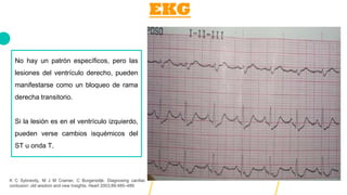EKG
No hay un patrón específicos, pero las
lesiones del ventrículo derecho, pueden
manifestarse como un bloqueo de rama
derecha transitorio.
Si la lesión es en el ventrículo izquierdo,
pueden verse cambios isquémicos del
ST u onda T.
K C Sybrandy, M J M Cramer, C Burgersdijk. Diagnosing cardiac
contusion: old wisdom and new Insights. Heart 2003;89:485–489
 