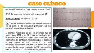CASO CLÍNICO
Se procedió a toma de EKG, biomarcadores y CAT.
EKG: Se evidencia elevación del segmentos ST
Biomarcadores: Troponina T 0,152
CAT: No se evidenció signos de lesión traumática
de la aorta o de contusión pulmonar, No se
encontró hematoma mediastinal.
El manejo inicial que se dio en urgencias fue el
protocolo de IAM, a las 12 horas, es evaluado por
el servicio de medicina interna y se consideró el
diagnóstico de contusión miocárdica por lo cual se
le pide realizar un ECO cardio TT, el cual
evidencio, cardiopatía dilatada con asincronía del
septum, trastornos de relajación del VI y pericarditis
leve sin derrame. Confirmando el diagnóstico.
 