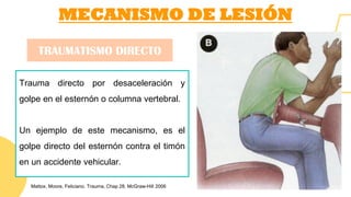 MECANISMO DE LESIÓN
Trauma directo por desaceleración y
golpe en el esternón o columna vertebral.
Un ejemplo de este mecanismo, es el
golpe directo del esternón contra el timón
en un accidente vehicular.
TRAUMATISMO DIRECTO
Mattox, Moore, Feliciano. Trauma, Chap 28. McGraw-Hill 2006
 