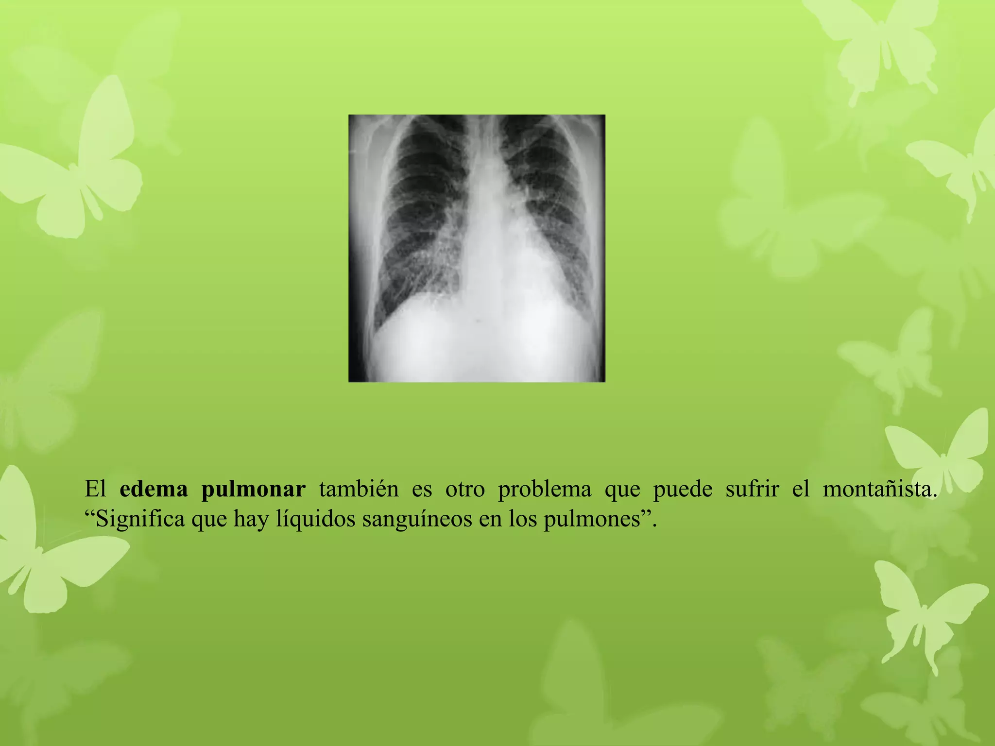 El edema pulmonar también es otro problema que puede sufrir el montañista.
“Significa que hay líquidos sanguíneos en los pulmones”.

 