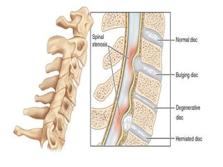 clinically oriented anatomy of the neck in humans | PPTX