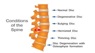 clinically oriented anatomy of human spinal column