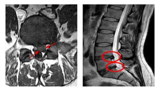 clinically oriented anatomy of human spinal column