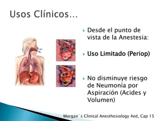 





Desde el punto de
vista de la Anestesia:
Uso Limitado (Periop)

No disminuye riesgo
de Neumonía por
Aspiración (Acides y
Volumen)

Morgan´s Clinical Anesthesiology 4ed, Cap 15

 